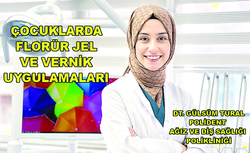 ÇOCUKLARDA FLORÜR JEL VE VERNİK UYGULAMALARI
